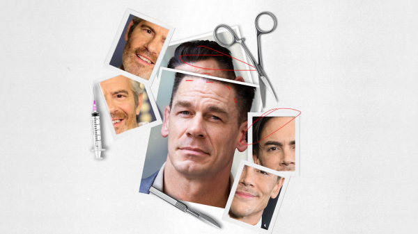 Famous Men Want You to Know What Work Theyve Had Done
